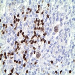 آنتی بادی BCL6 برند NOVOCELL