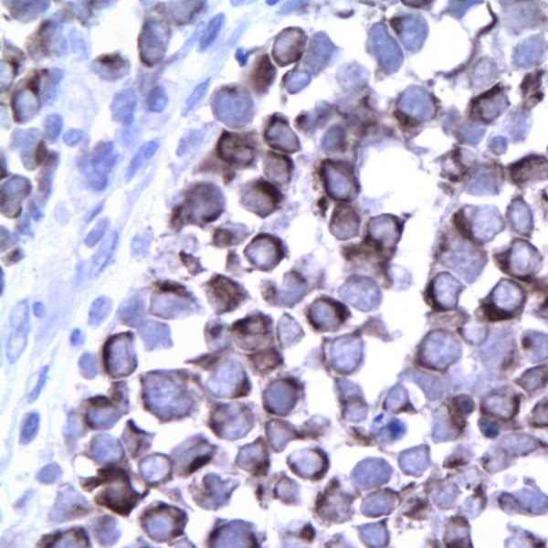 آنتی بادی Cytokeratin Pan AE1/E3 (PAN)  برند NOVOCELL