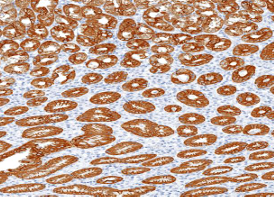 آنتی بادی Cytokeratin CK8  برند NOVOCELL