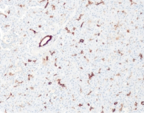 آنتی بادی Cytokeratin 7  برند NOVOCELL