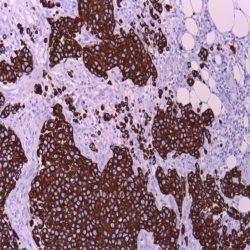 آنتی بادی Chromogranin A  برند NOVOCELL