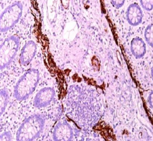 آنتی بادی Desmin  برند NOVOCELL