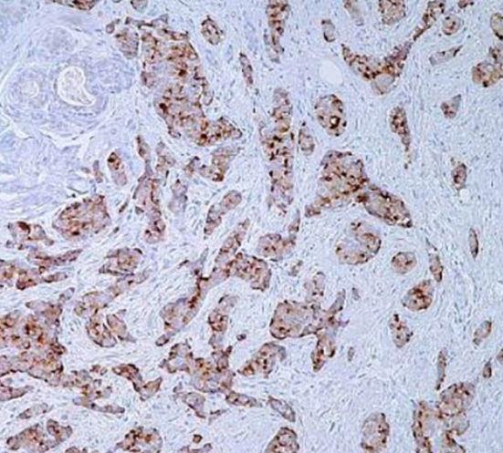 آنتی بادی EMA  برند NOVOCELL