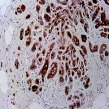 آنتی بادی HMB45  برند NOVOCELL