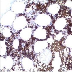 آنتی بادی S100  برند NOVOCELL