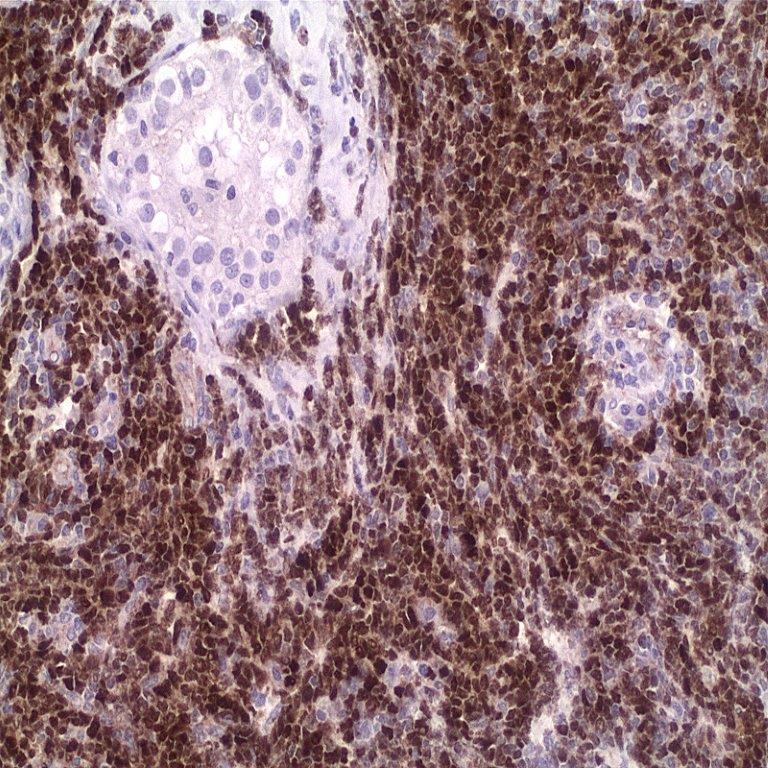 آنتی بادی TDT  برند NOVOCELL