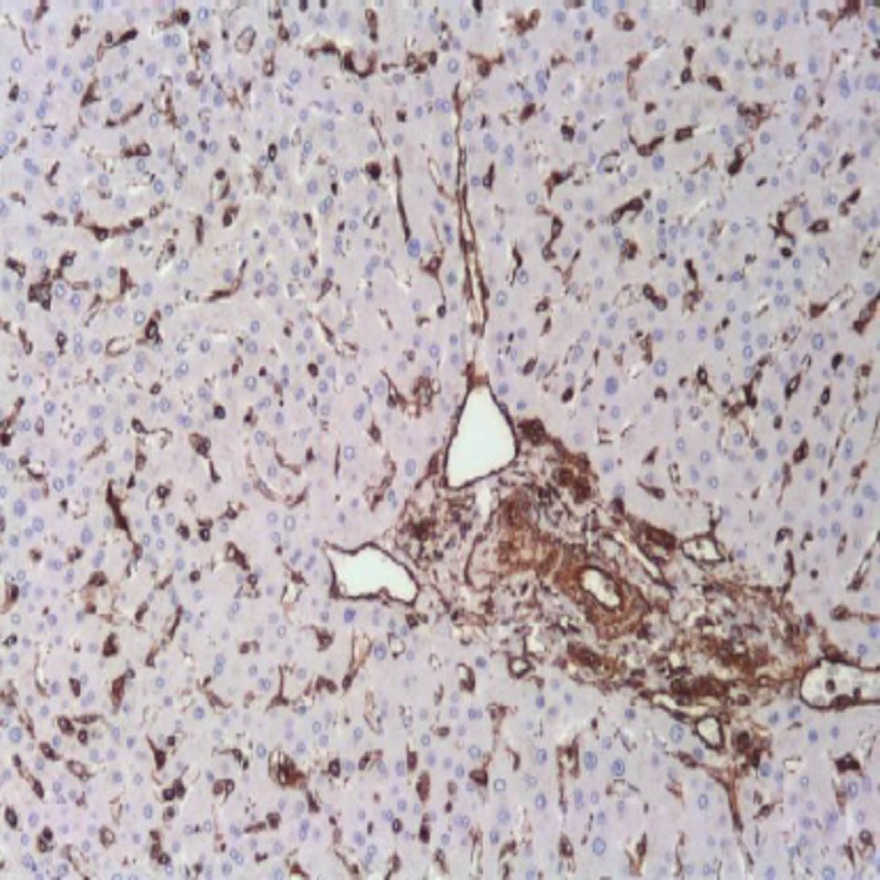 آنتی بادی Vimentin  برند NOVOCELL