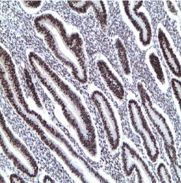 آنتی بادی PR برند NOVOCELL