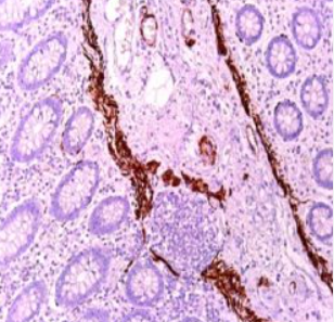 آنتی بادی ER برند NOVOCELL