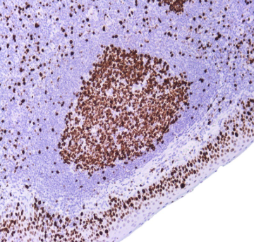 آنتی بادی Ki67 برند NOVOCELL