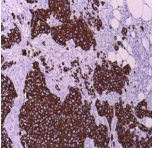 آنتی بادی PMS2 برند NOVOCELL