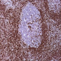 آنتی بادی CD20 برند NOVOCELL