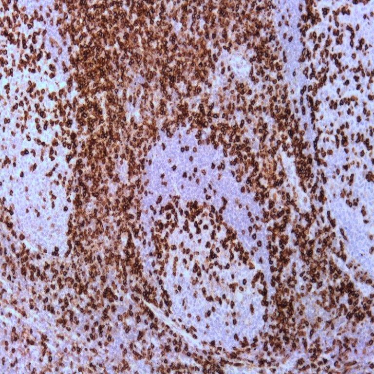 آنتی بادی(CD45(LCA برند NOVOCELL